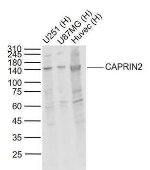CAPRIN2 Rabbit Polyclonal Antibody