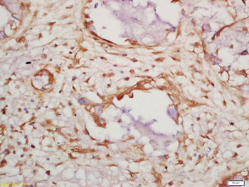 Caspase-14 p10 Rabbit Polyclonal Antibody