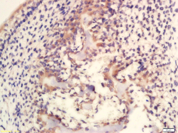 Caspase-14 p10 Rabbit Polyclonal Antibody