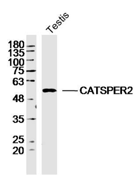 CATSPER2 Rabbit Polyclonal Antibody