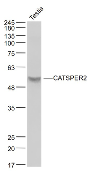 CATSPER2 Rabbit Polyclonal Antibody