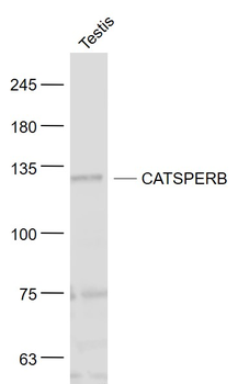 CATSPERB Rabbit Polyclonal Antibody