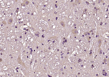 CBLN1 Rabbit Polyclonal Antibody