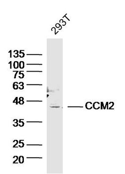 CCM2 Rabbit Polyclonal Antibody