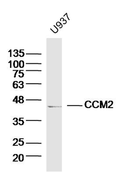 CCM2 Rabbit Polyclonal Antibody