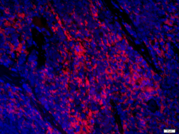 Phospho-ITGB2 (Ser756) Rabbit Polyclonal Antibody
