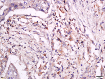 Phospho-ITGB2 (Thr758) Rabbit Polyclonal Antibody