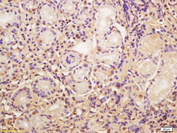 CDC5L Rabbit Polyclonal Antibody