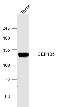CEP135 Rabbit Polyclonal Antibody