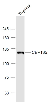 CEP135 Rabbit Polyclonal Antibody