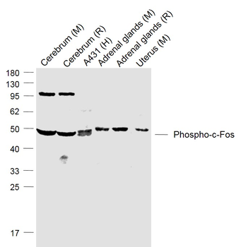 Phospho-c-Fos (Ser362) Rabbit Polyclonal Antibody