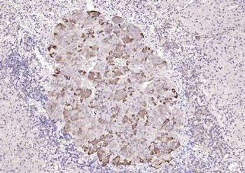 Chemerin Rabbit Polyclonal Antibody
