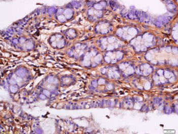 Chemerin Rabbit Polyclonal Antibody