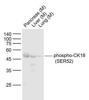 Phospho-CK18 (Ser52) Rabbit Polyclonal Antibody