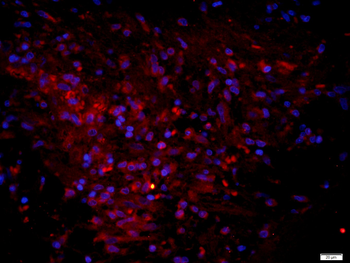 CLIC6 Rabbit Polyclonal Antibody