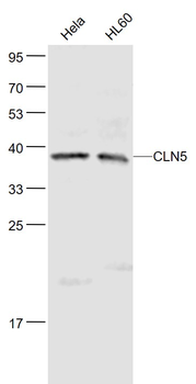 CLN5 Rabbit Polyclonal Antibody
