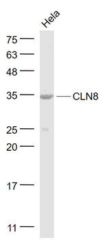 CLN8 Rabbit Polyclonal Antibody