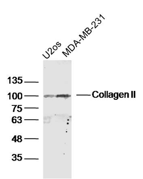 Collagen II Rabbit Polyclonal Antibody
