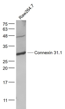 Connexin 31.1 Rabbit Polyclonal Antibody