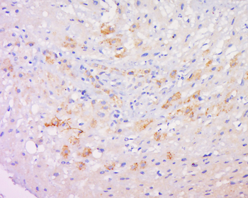 Copine-6 Rabbit Polyclonal Antibody