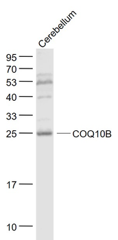COQ10B Rabbit Polyclonal Antibody