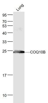 COQ10B Rabbit Polyclonal Antibody