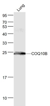 COQ10B antibody