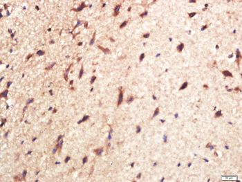 CPLX1 Rabbit Polyclonal Antibody