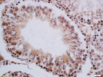 CRBN Rabbit Polyclonal Antibody