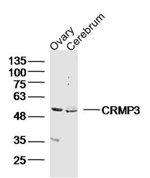CRMP3 Rabbit Polyclonal Antibody