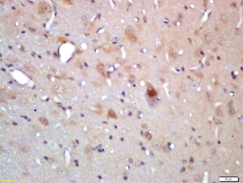 CRY2 Rabbit Polyclonal Antibody