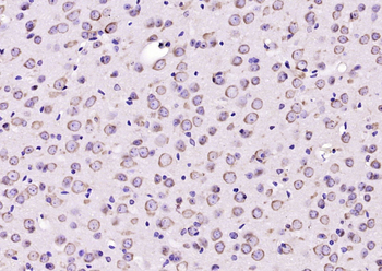 CSAD Rabbit Polyclonal Antibody