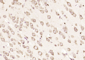 CSAD Rabbit Polyclonal Antibody