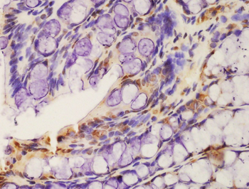 Phospho-CSK (Ser364) Rabbit Polyclonal Antibody