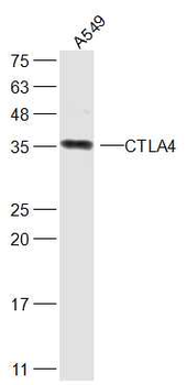 CTLA4 Rabbit Polyclonal Antibody