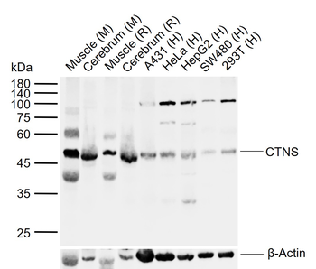 CTNS Rabbit Polyclonal Antibody