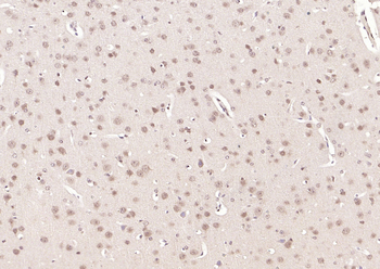 CWC22 Rabbit Polyclonal Antibody