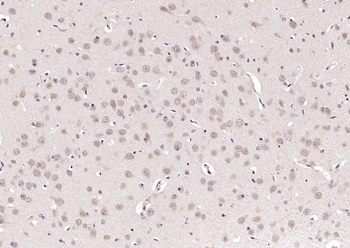 CWC22 Rabbit Polyclonal Antibody