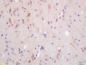 ACKR3 Rabbit Polyclonal Antibody