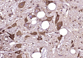 Cytohesin 2 Rabbit Polyclonal Antibody