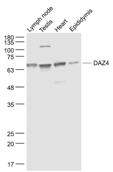 DAZ4 Rabbit Polyclonal Antibody