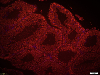 DAZL Rabbit Polyclonal Antibody
