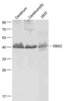 DBX2 Rabbit Polyclonal Antibody