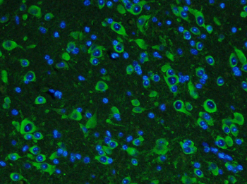 GDNF Rabbit Polyclonal Antibody (FITC)