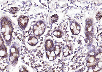 Defensin alpha 5 Rabbit Polyclonal Antibody