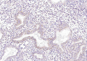 Defensin alpha 5 Rabbit Polyclonal Antibody