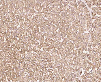 DGAT2 Rabbit Polyclonal Antibody
