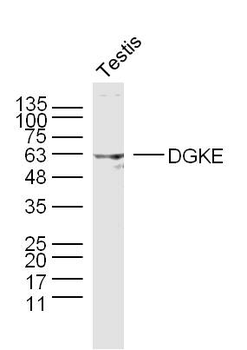 DGKE Rabbit Polyclonal Antibody
