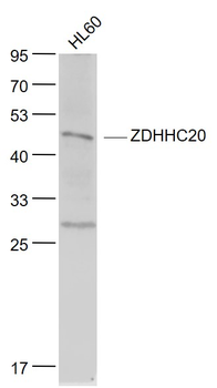 ZDHHC20 Rabbit Polyclonal Antibody