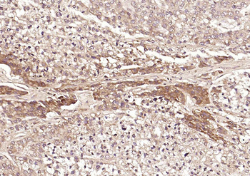 DLST Rabbit Polyclonal Antibody